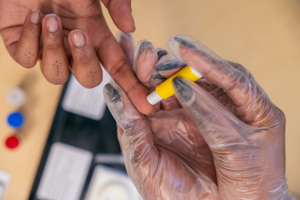 Close-up photo of someone doing a finger-prick test for HIV